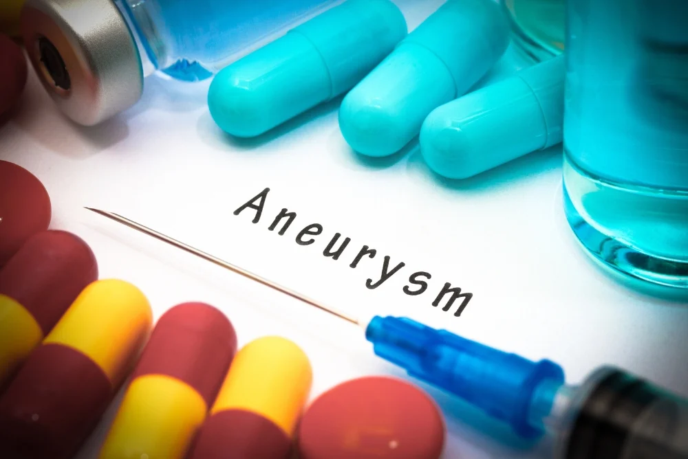 Benefits and Risks of Aneurysm Coiling Treatment